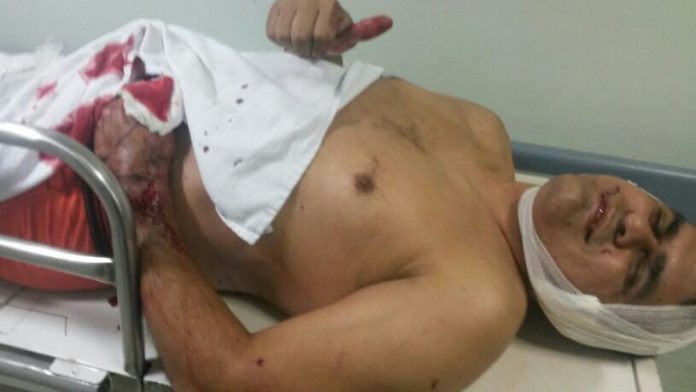 Policial tentar acaacado p[or dono de barbar confusão mas é at