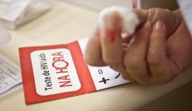MS libera recursos para combate à AIDS no AM
