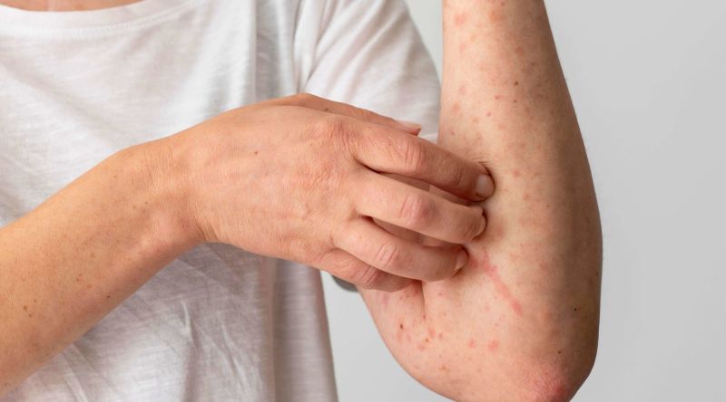 skin-allergy-reaction