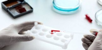 Infecções assintomáticas dificultam diagnóstico e erradicação da malária no Brasil