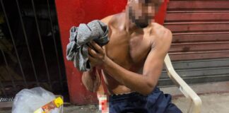 Venezuelano tem dedos decepados durante assalto no bairro Parque das Laranjeiras, em Manaus