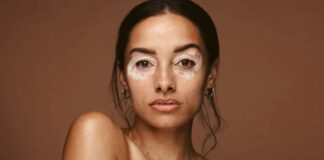 Novas terapias ampliam perspectivas para o tratamento do vitiligo